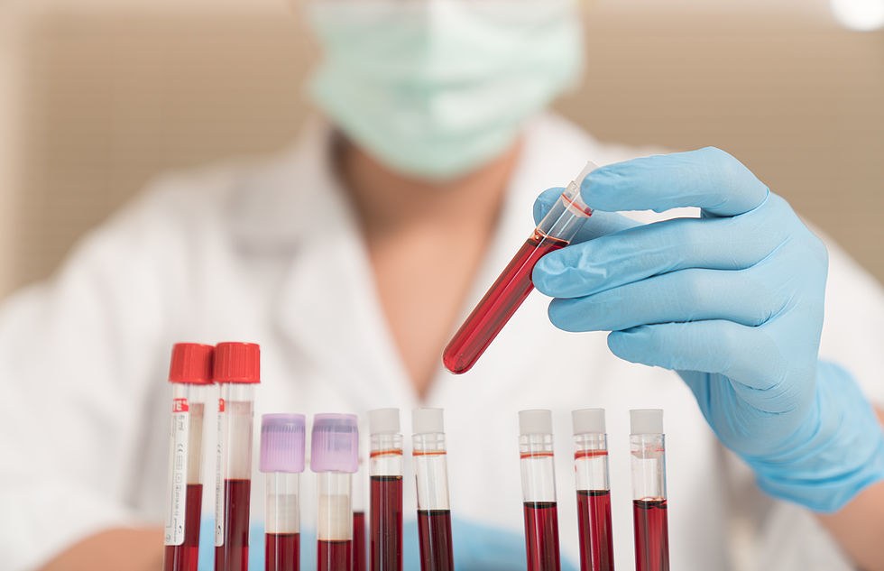 В лабораторных условиях параллельно делают общую биохимию крови и при необходимости анализ на гормоны (инсулин, тироксин)