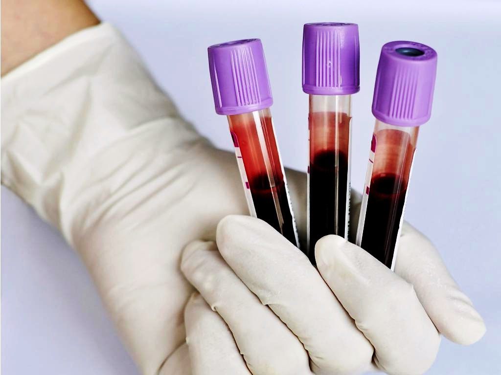 Количество иммуноглобулинов определяют в венозной крови